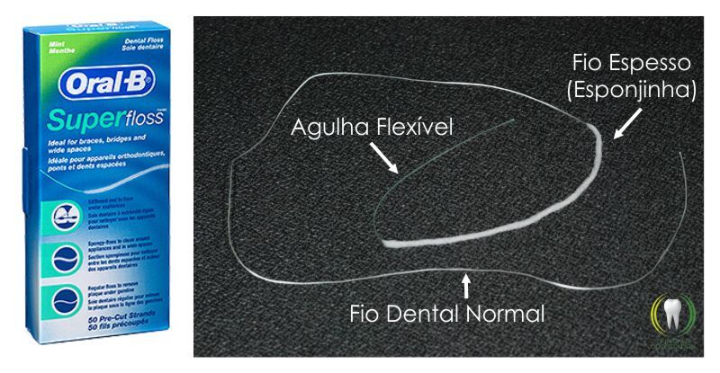 Fio Dental e Aparelho Ortodôntico: 6 dicas para facilitar o uso ...